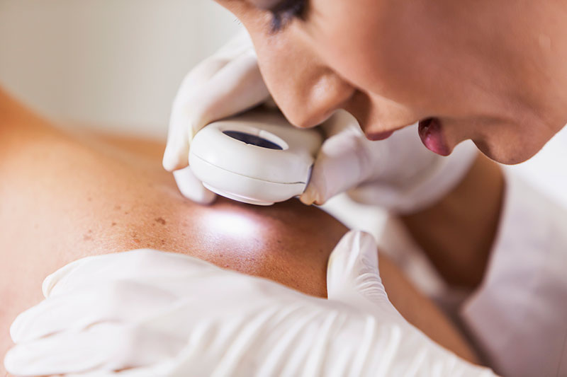From Acne to Skin Cancer, We're Here to Help