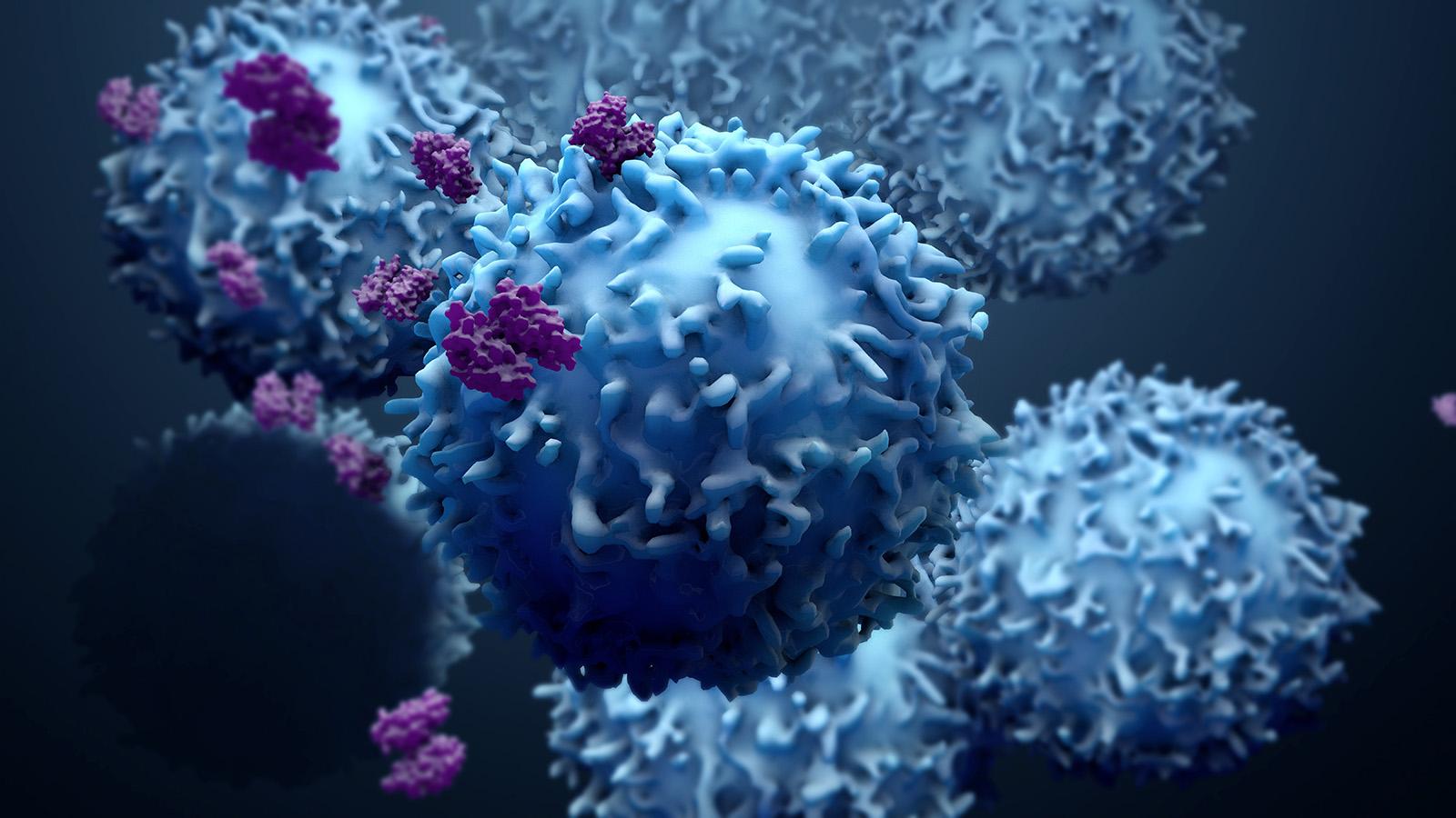 Immune cells may improve accuracy of predicting survival in colorectal cance