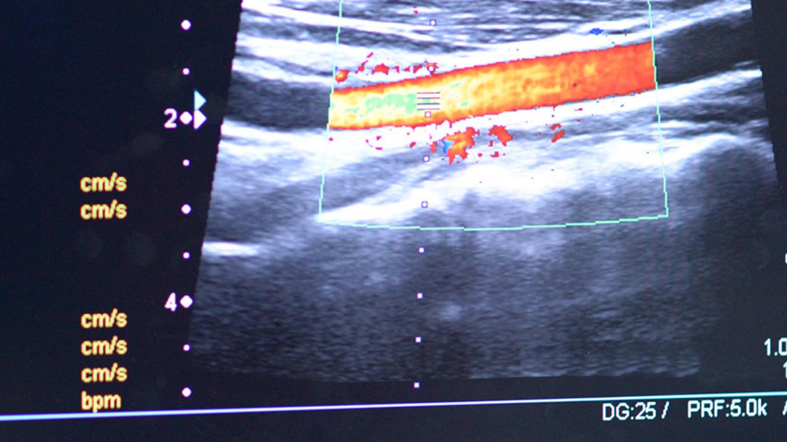 Vascular and Endovascular Surgery