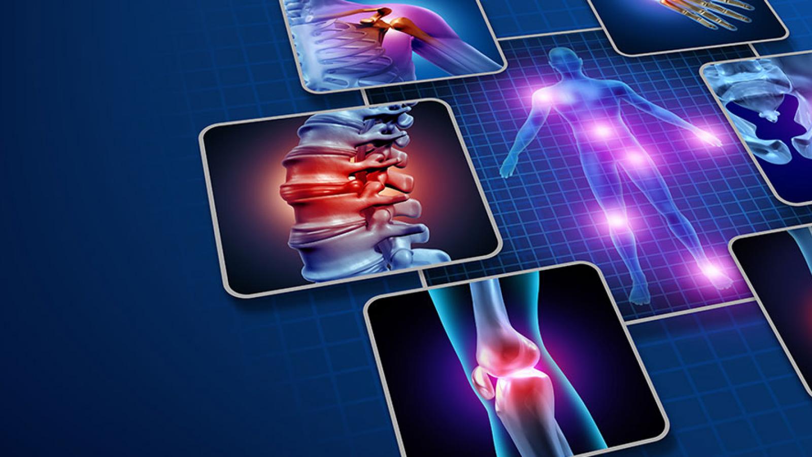Arthritis Knee Pain Center Columbia Sc Outlet