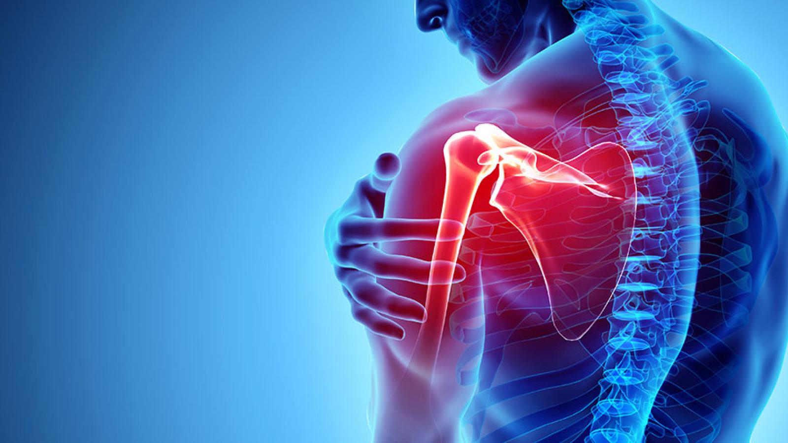 Shoulder Pain - Florida Ortho Care