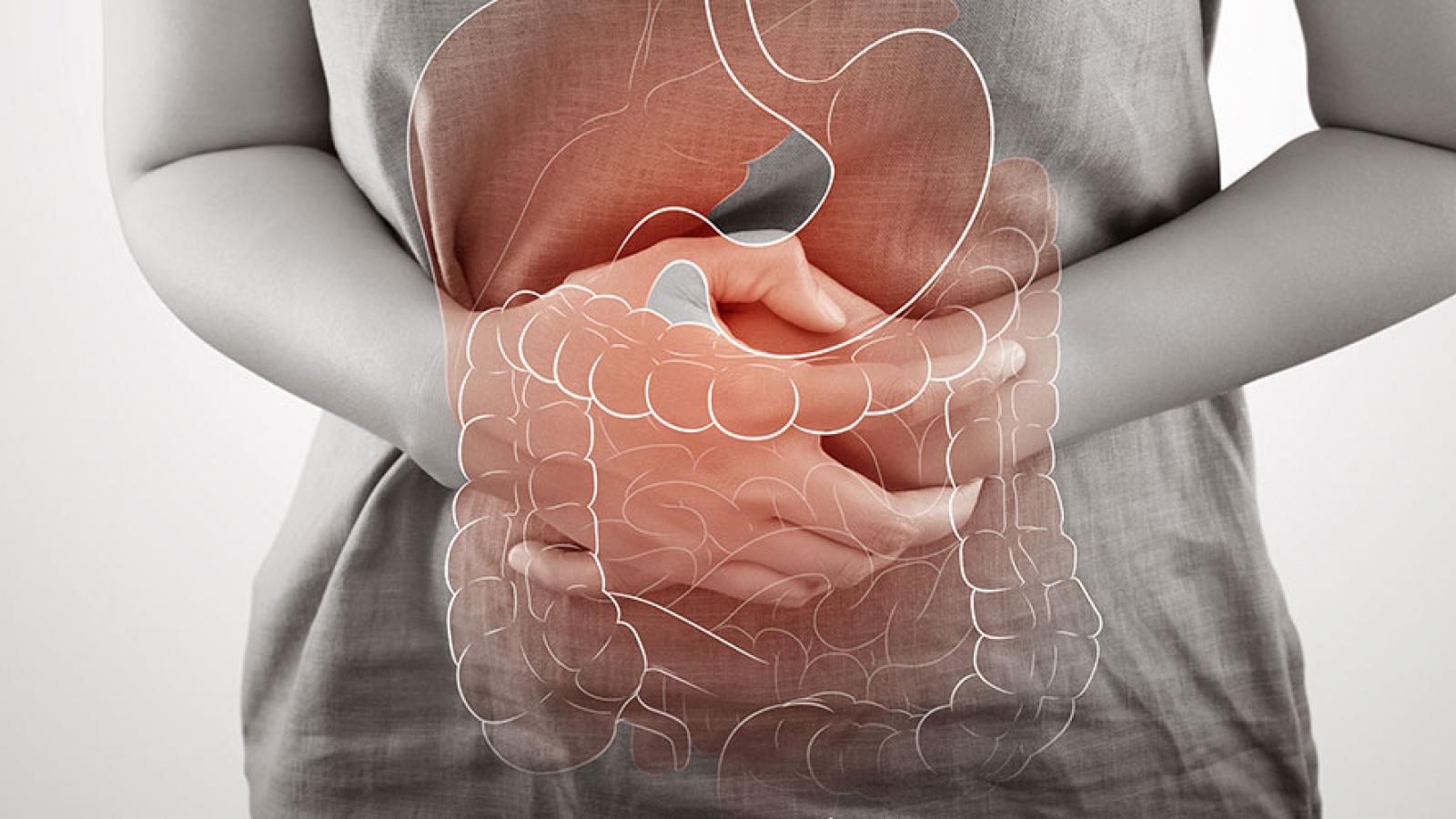 Inflammatory Bowel Disease or IBD