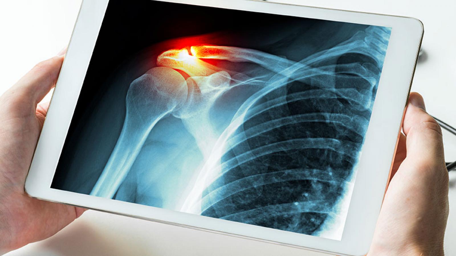 Shoulder Surgery Guthrie