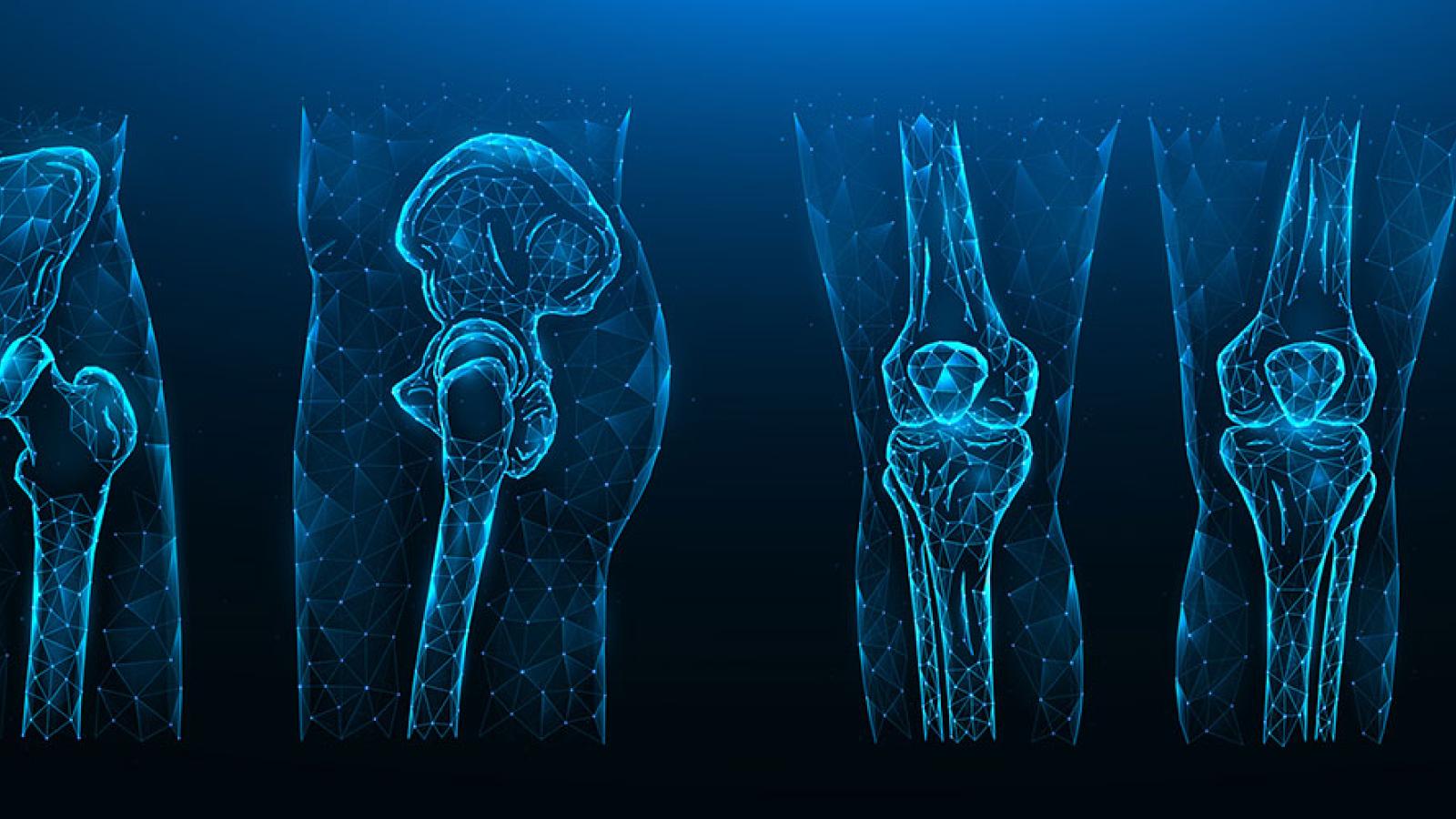 Musculoskeletal Imaging  