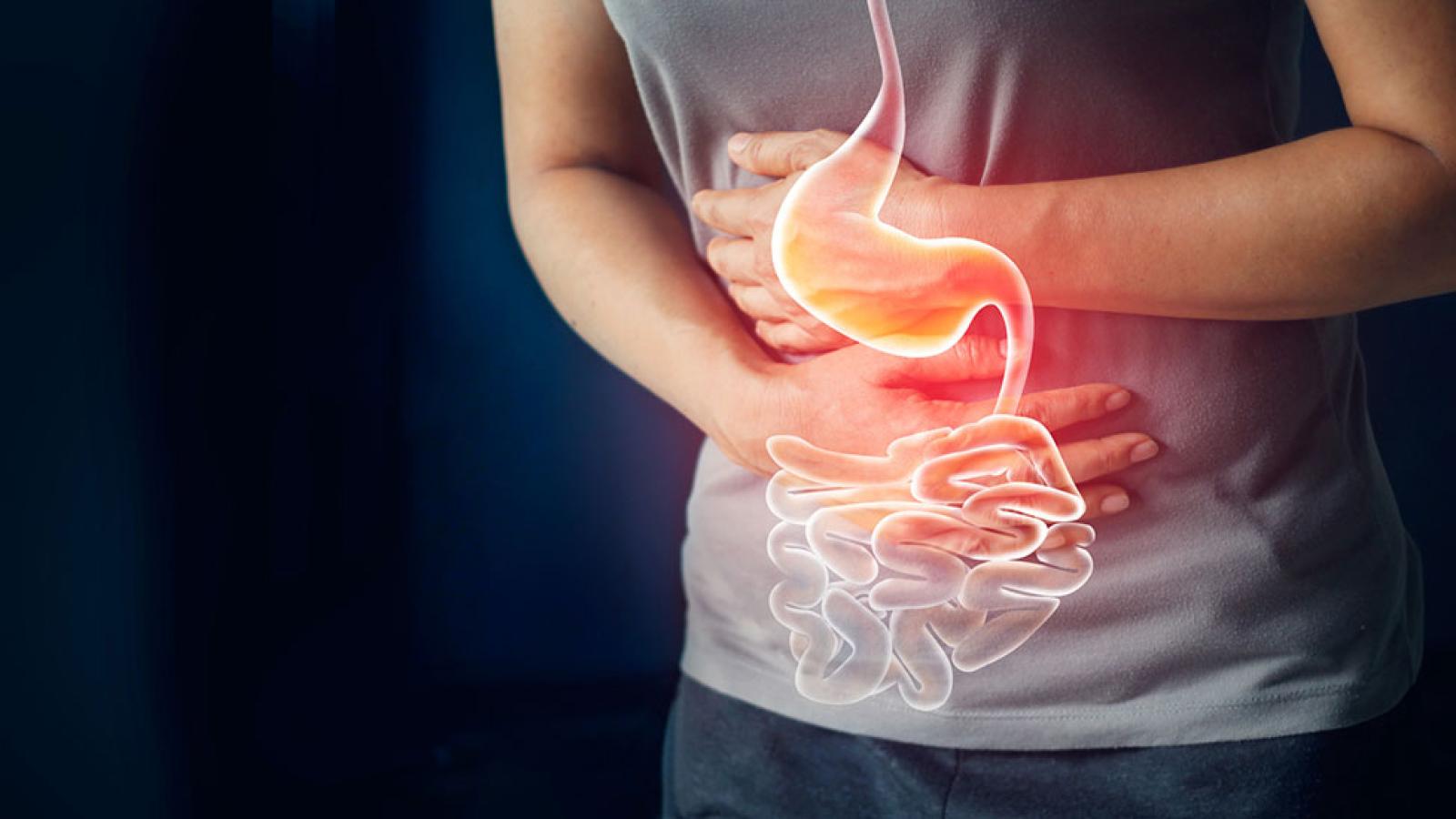 Advanced GERD Treatment