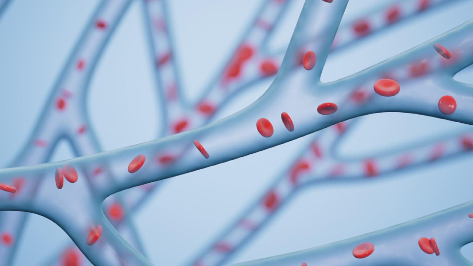 Vascular Surgery Clinical Trials