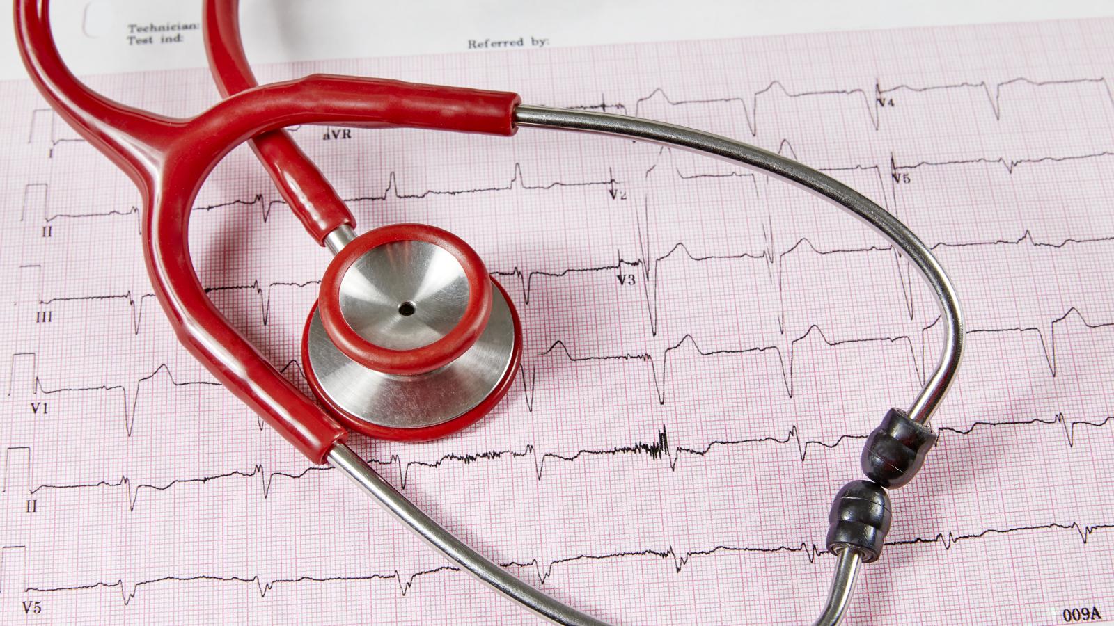 What Does It Mean If I Have an Irregular Heartbeat?