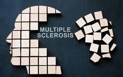 Don’t Miss These Signs of Multiple Sclerosis