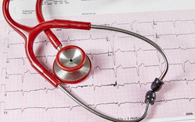 What Does It Mean If I Have an Irregular Heartbeat?