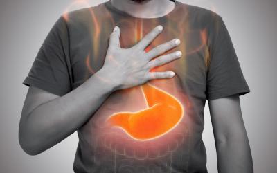 Acid Reflux Q&A